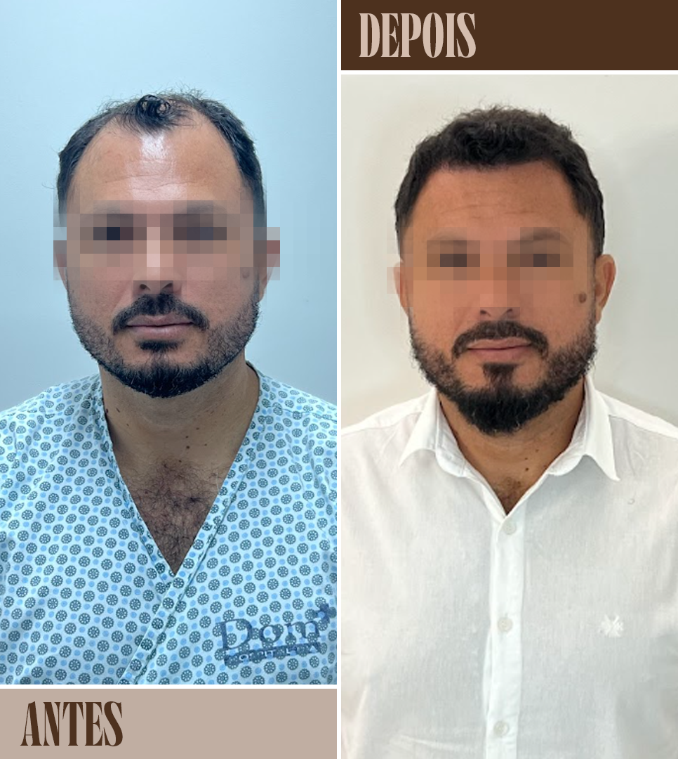 Resultado-01